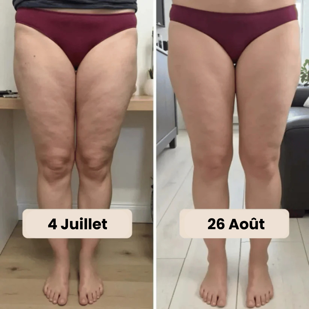 Short Legging 3D Anti-Cellulite